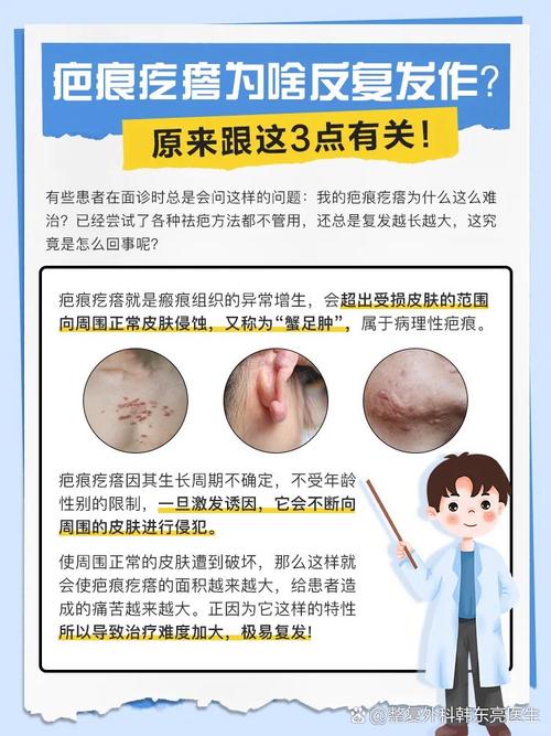 激光祛痘印会复发吗？-图1