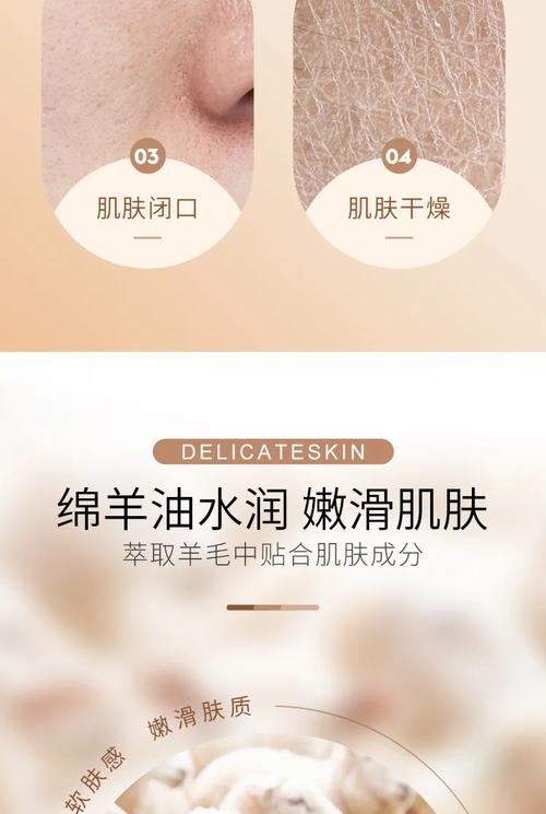 绵羊油真能消炎祛痘吗？-图3