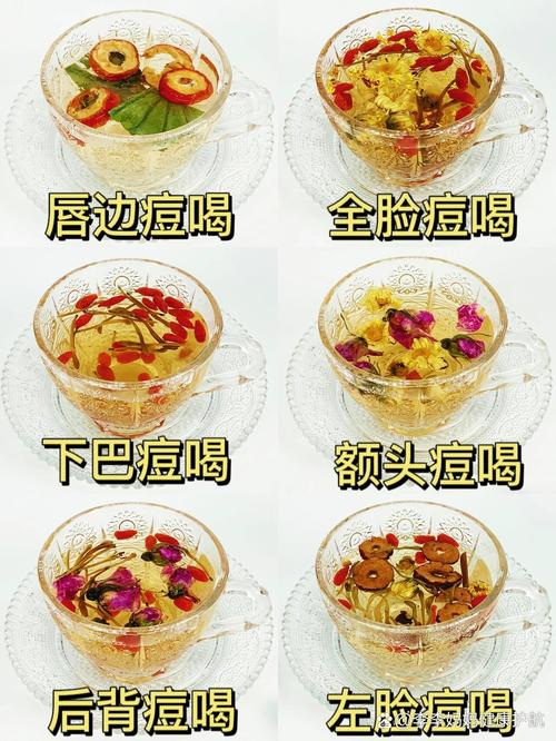 夏天祛痘喝什么茶最有效？-图3