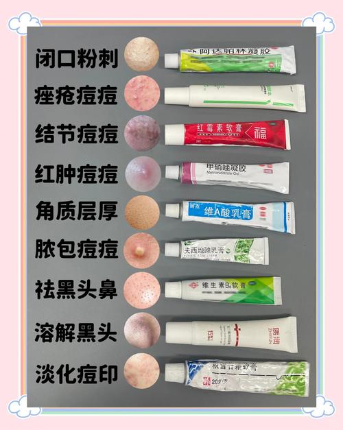 祛痘产品哪种最有效？-图3