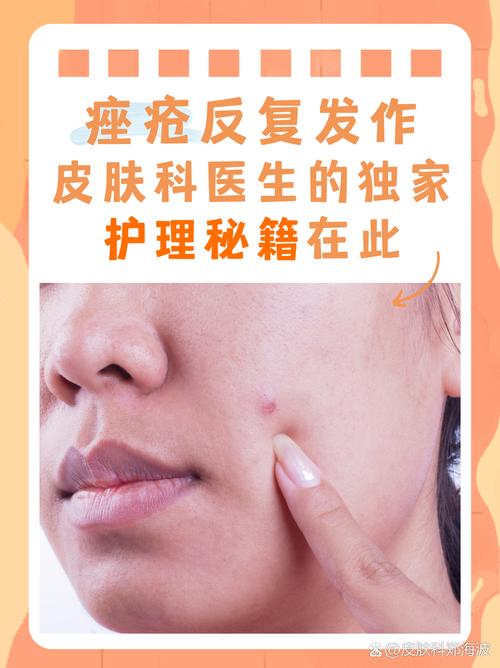 油皮祛痘真不用保湿吗？-图3