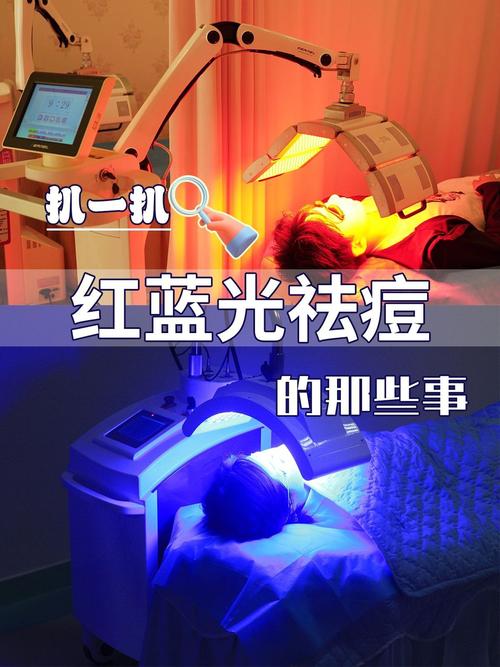 激光祛痘和红蓝光是一回事吗？-图1