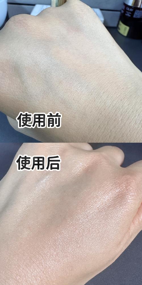 茶籽油祛痘官网，真有轻中度痘效？-图3