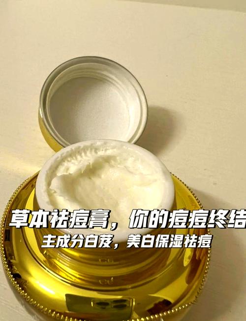 祛痘膏什么牌子最有效？-图1