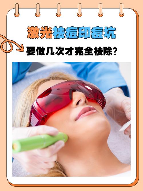 脉冲激光祛痘效果到底怎么样？-图1