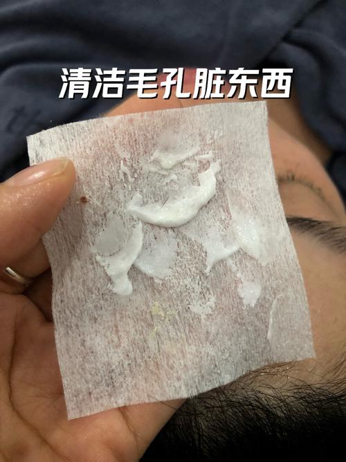 海藻面膜加什么能祛痘印？-图1