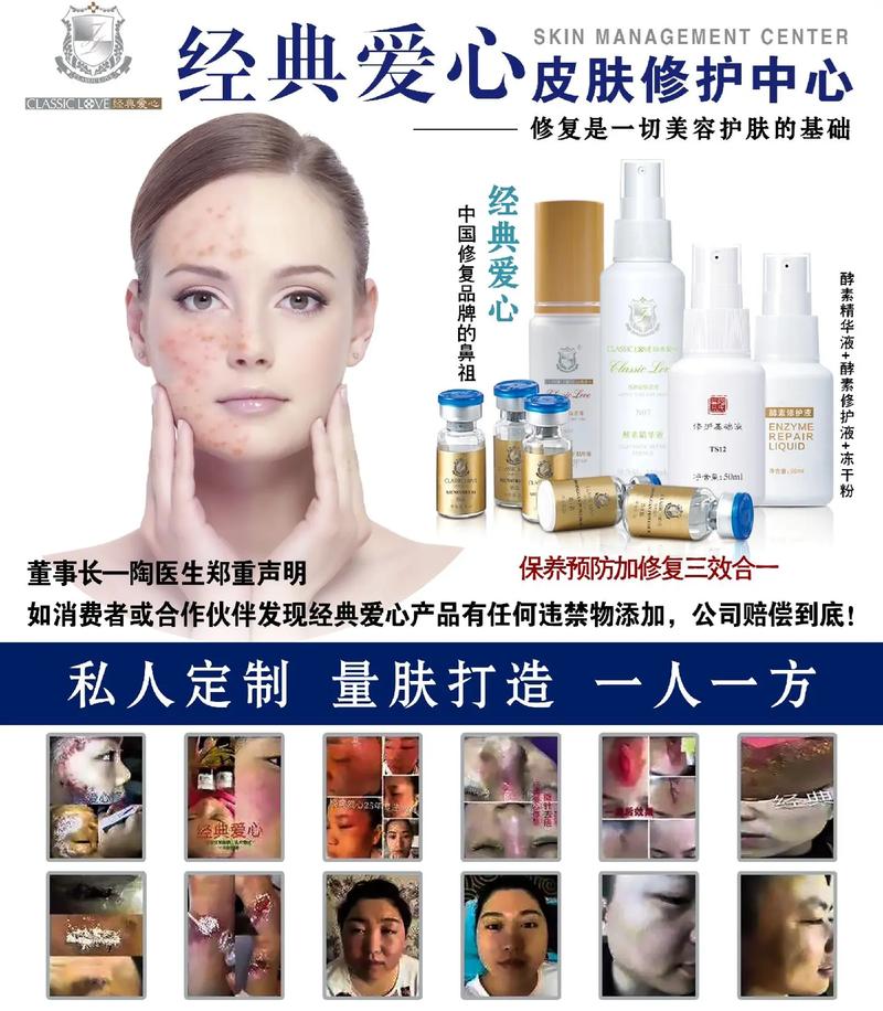 海藻面膜加什么能祛痘印？-图3