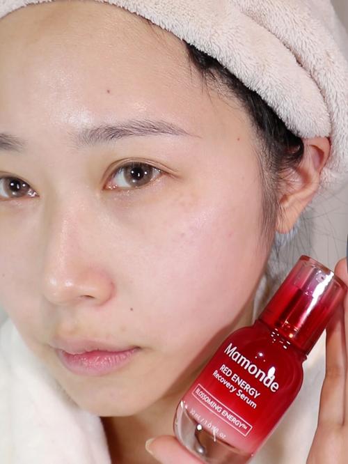 脂肪填充后护肤品怎么选?-图3 脂肪填充后护肤品怎么选?-图3