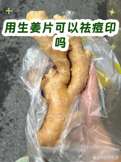 生姜敷脸真能祛痘吗？-图2