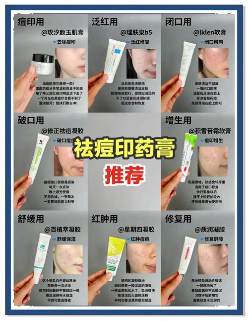 祛痘吃哪种维生素？痘印又该补哪种？-图1