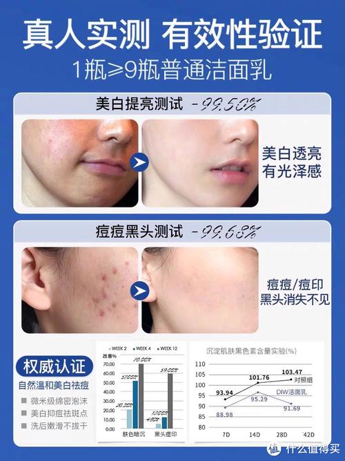 祛斑祛痘洗面奶真的有效吗？-图1