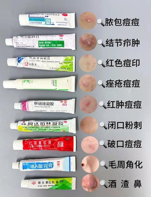 祛痘护肤到底能用几种产品？-图3