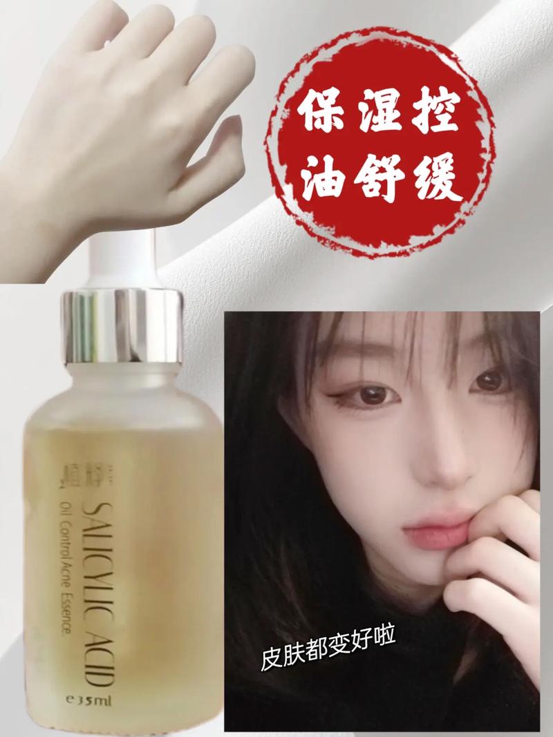 薇诺娜祛痘真的有效吗？-图3