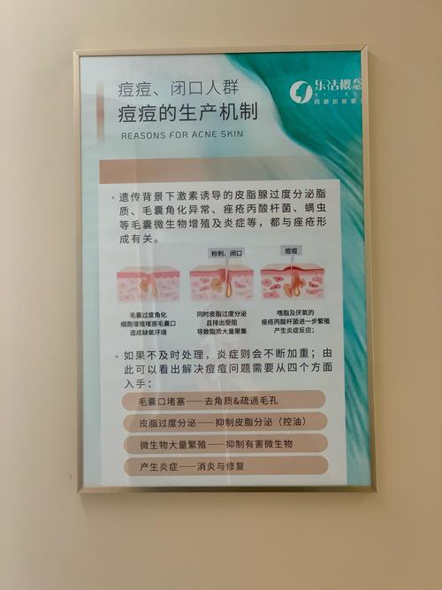 男士祛痘产品真的有效吗？-图2