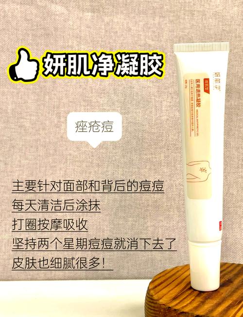 中药祛痘选哪些？-图3