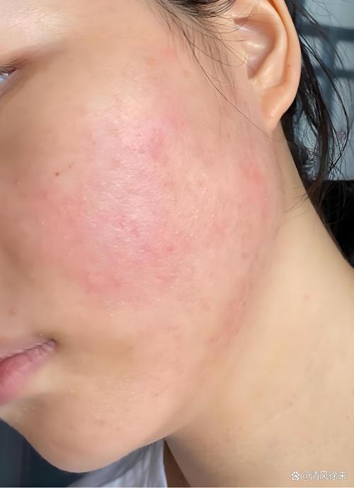 油敏肌怎么选护肤品？-图3