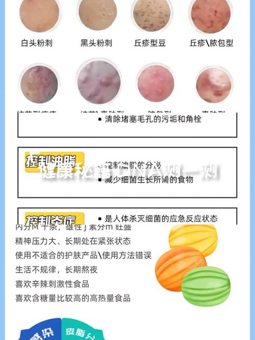 祛痘后如何护理不留痘印?-图1 祛痘后如何护理不留痘印?-图1