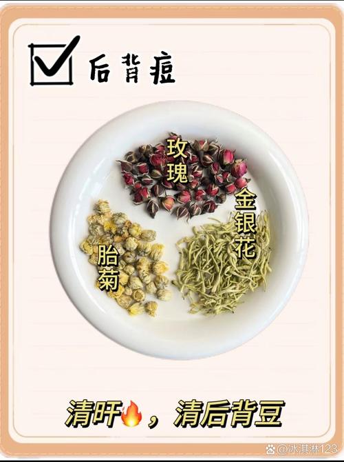 什么中药泡水能祛痘粉刺？-图1