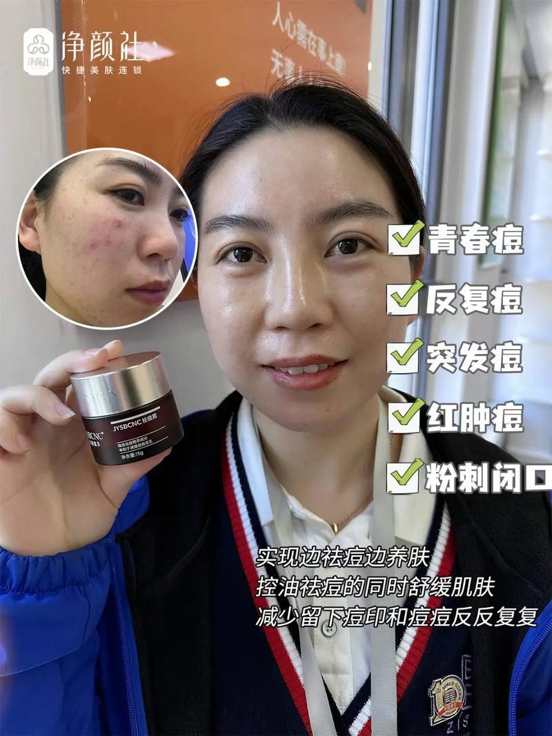 古痘净本草祛痘液官网是正品吗？-图3