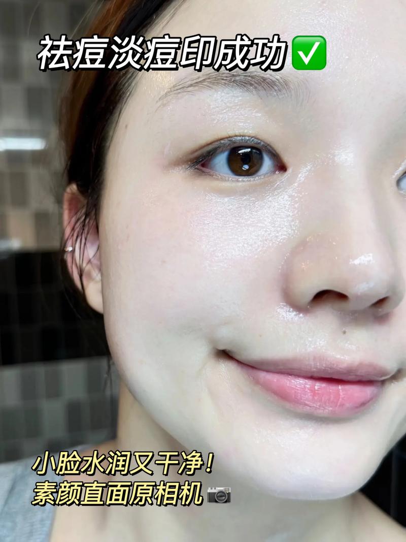 祛痘面膜真的能祛痘吗?-图1 祛痘面膜真的能祛痘吗?-图1