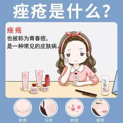 祛痘产品排毒期间会爆痘吗?-图2 祛痘产品排毒期间会爆痘吗?-图2