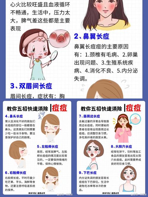 脸上长痘怎么排毒祛痘?-图2 脸上长痘怎么排毒祛痘?-图2