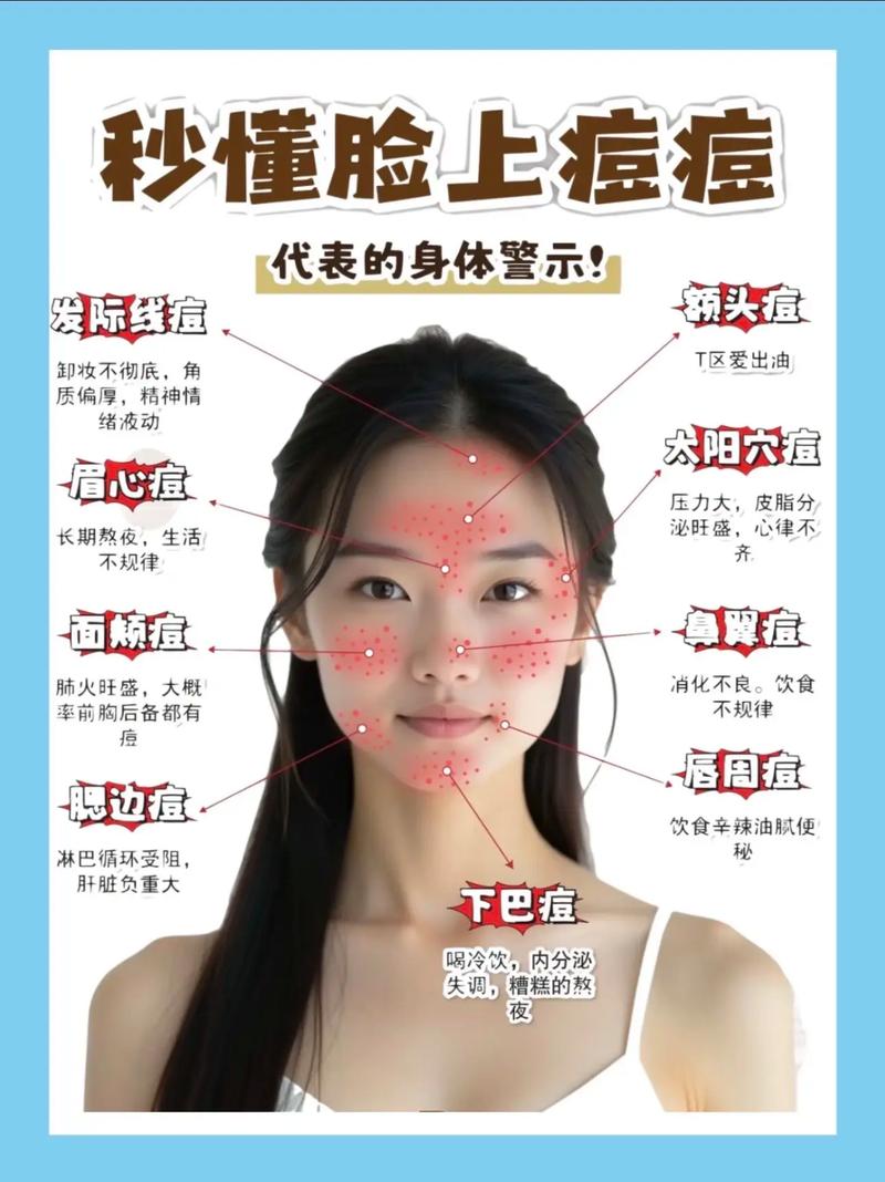 明星长痘怎么快速祛痘？-图3