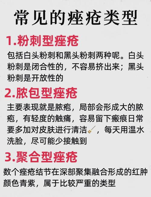 祛痘针后如何正确护理？-图2