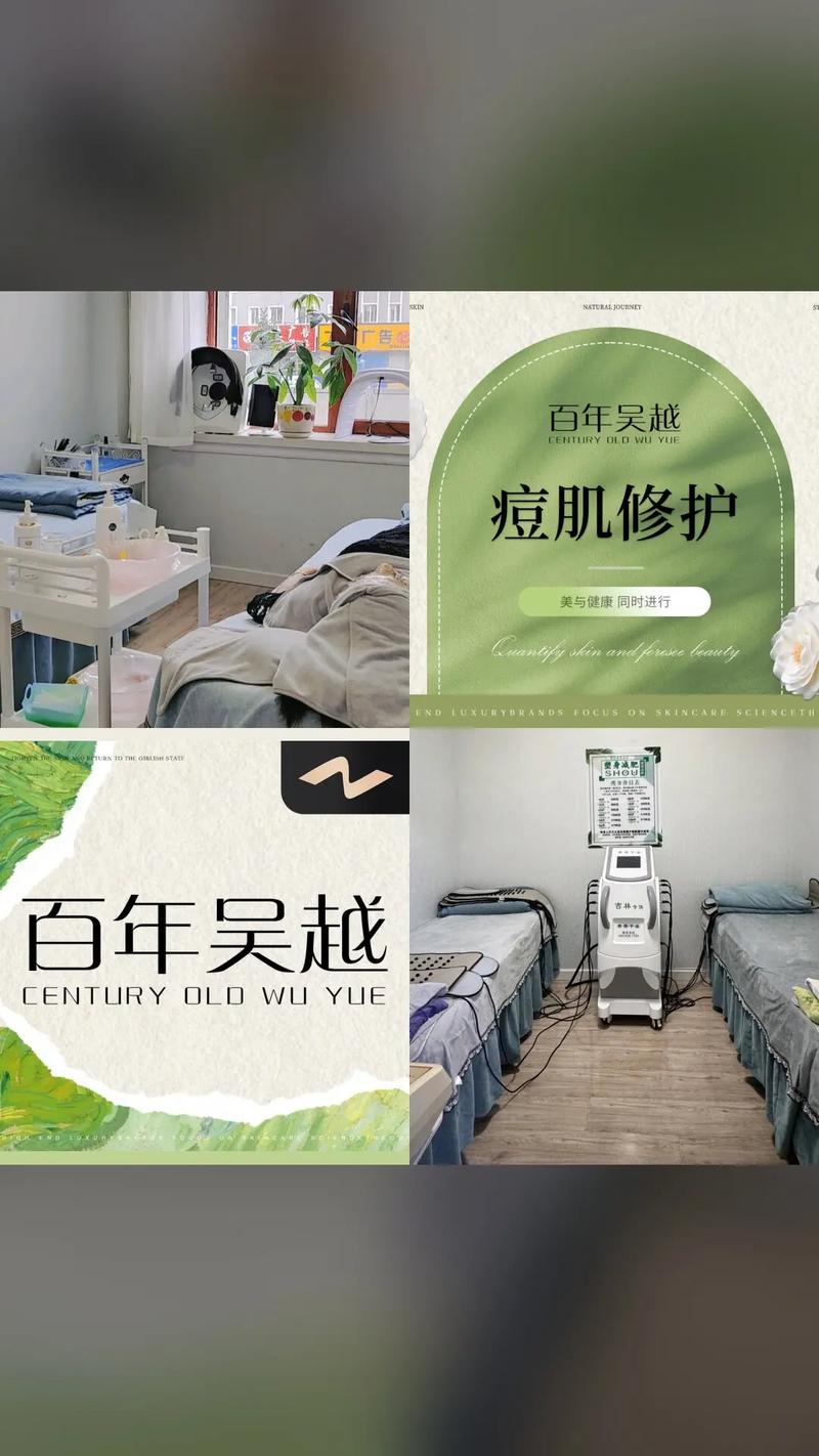 百年吴越祛痘印多少钱?效果好吗?-图1 百年吴越祛痘印多少钱?效果好吗?-图1