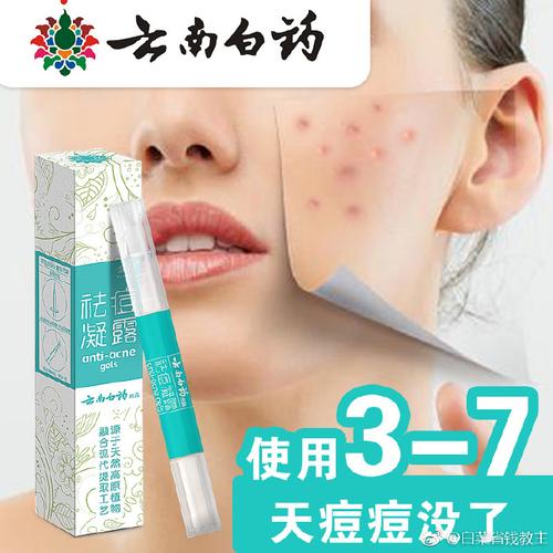 云南白药祛痘膏效果真的好吗？-图1