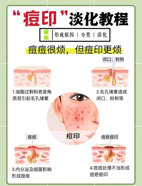 如何有效祛痘印？-图2