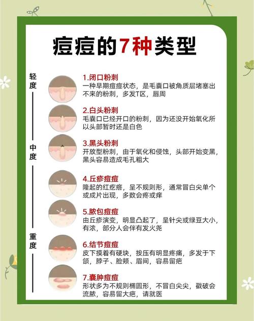 维E维C搭配能祛痘吗？-图2