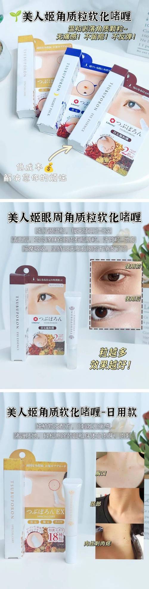 脂肪粒怎么选护肤品？-图1