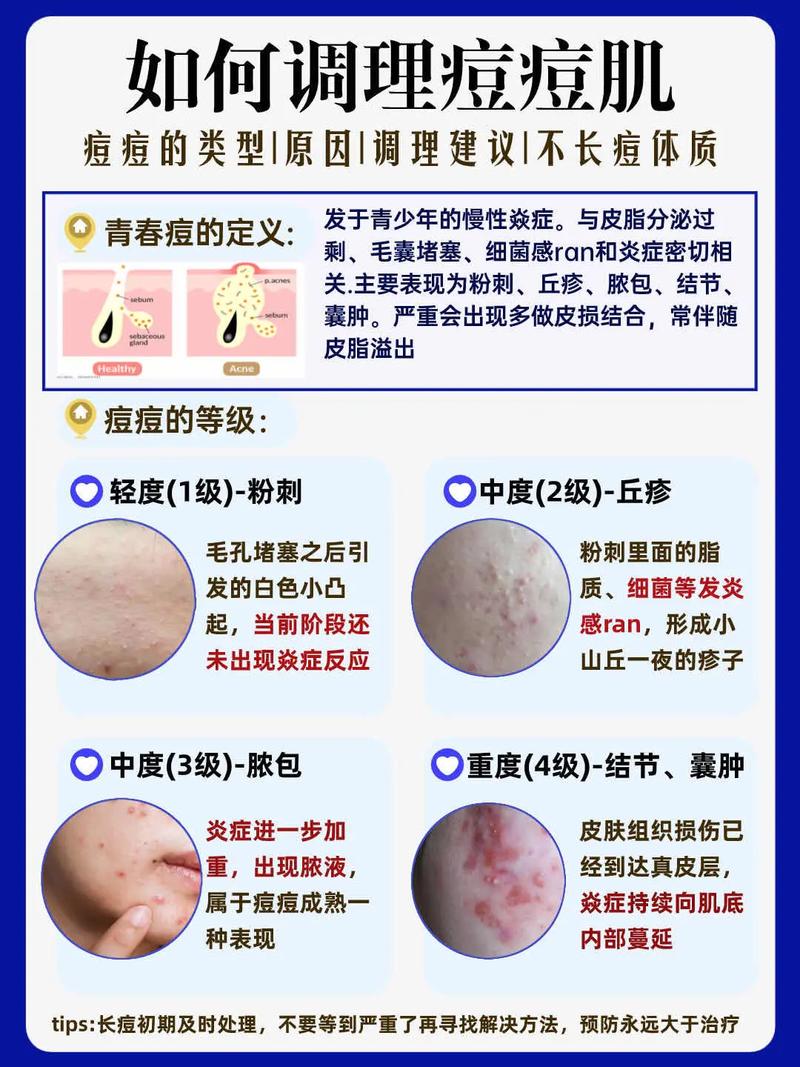 祛痘产品过敏后该怎么办？-图3