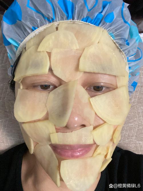 土豆片敷脸真能祛痘吗？-图1