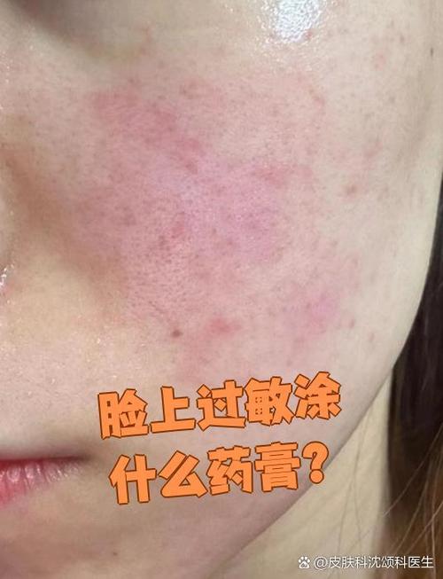 过敏肌护肤品怎么选？-图1