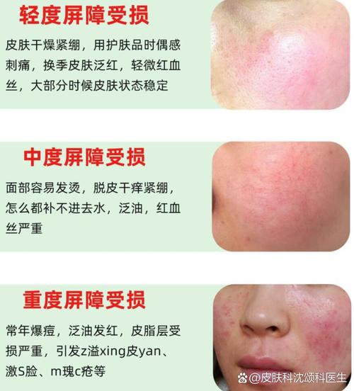 过敏肌护肤品怎么选？-图2