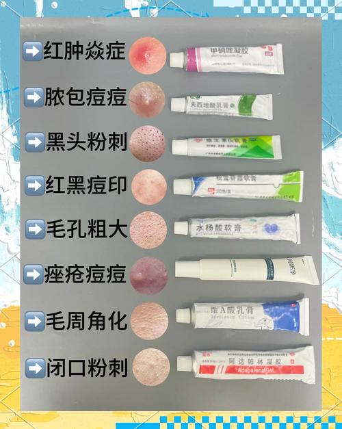 祛痘印用什么方法最有效？-图1