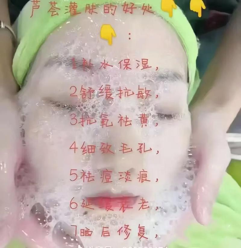 芦荟擦脸真能祛痘吗？-图3