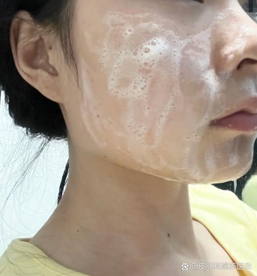 护肤品用完脸黏黏怎么办？-图1