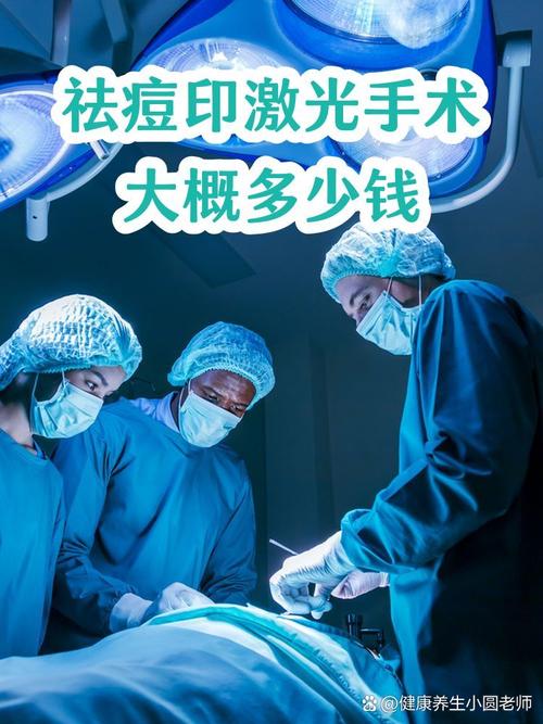 激光祛痘手术一般要花多少钱？-图2