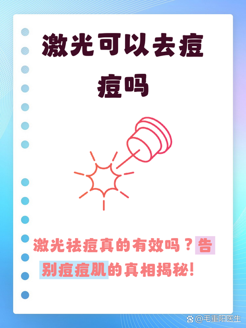 激光祛痘有哪些副作用？-图2