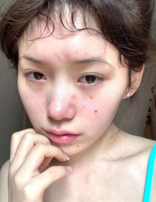 韩之花酿祛痘效果真的好吗？-图2