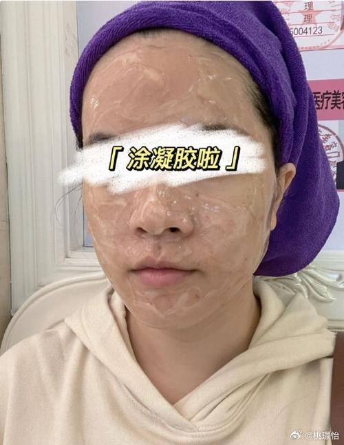 微针和激光祛痘，到底哪个更适合你？-图3