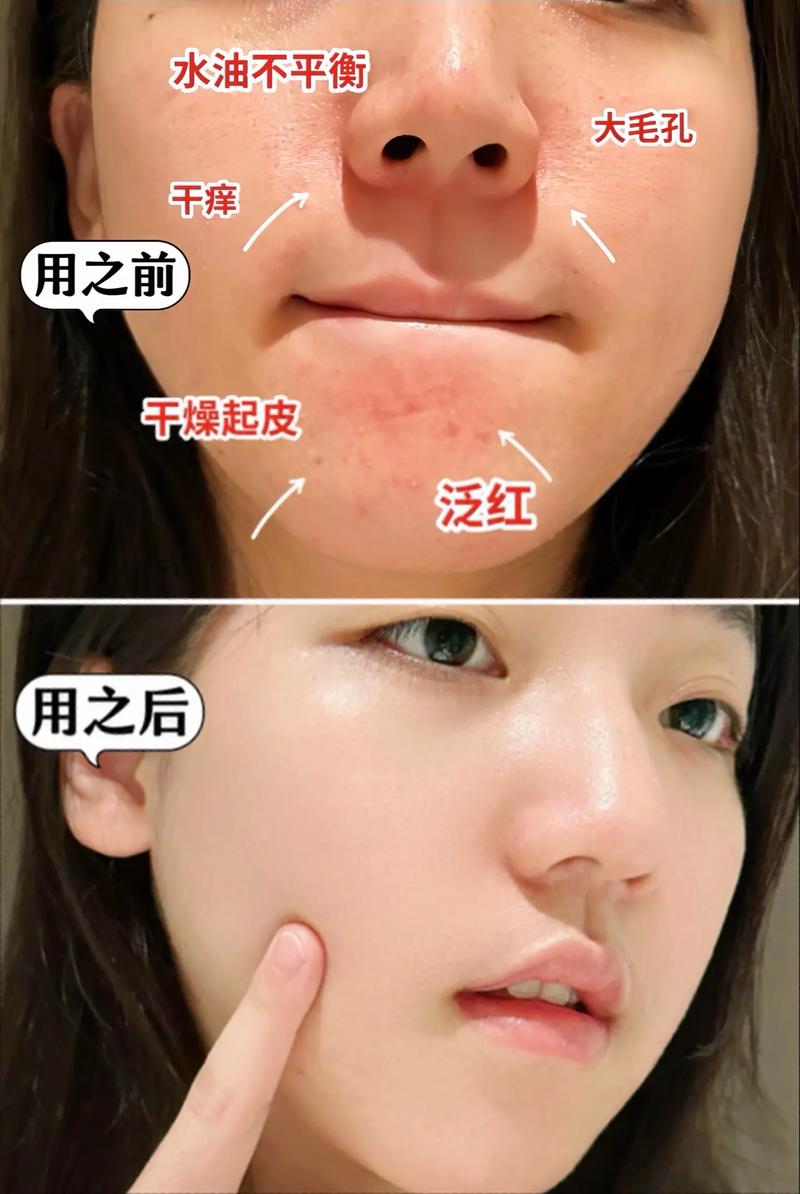 不洗脸竟是最好的护肤？真相是？-图2