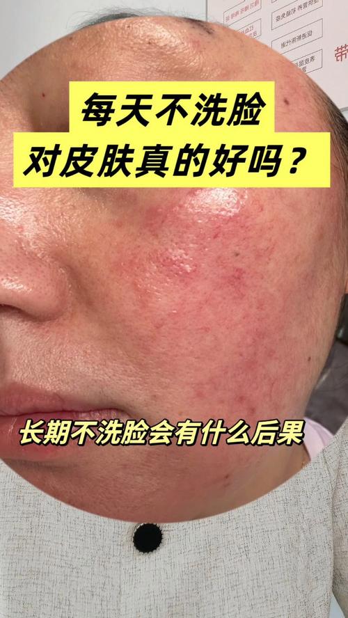 不洗脸竟是最好的护肤？真相是？-图3