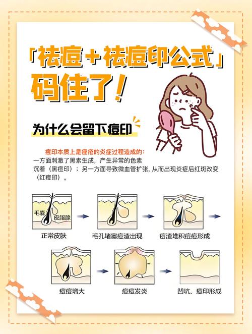 美白祛痘印哪种方法最好？-图2