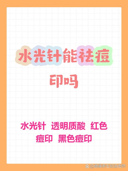 打水光针能祛痘印吗？-图3