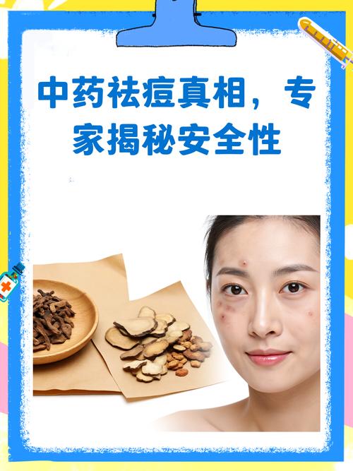 中药祛痘效果真的好吗？-图3