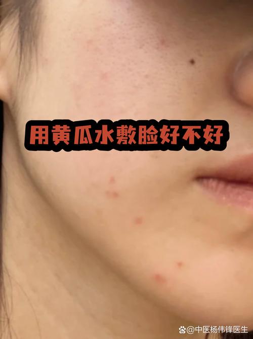 黄瓜敷脸真能祛痘印吗？-图2